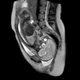Illustration for article titled Bonus: Stills Of The MRI Live Birth